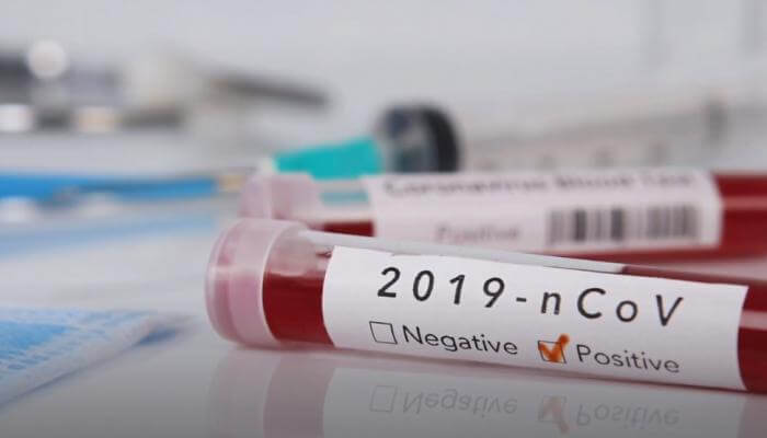 Koronavirusa yoluxanların bu günə olan statistikası