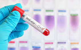 Peyvənd olunanların sayı