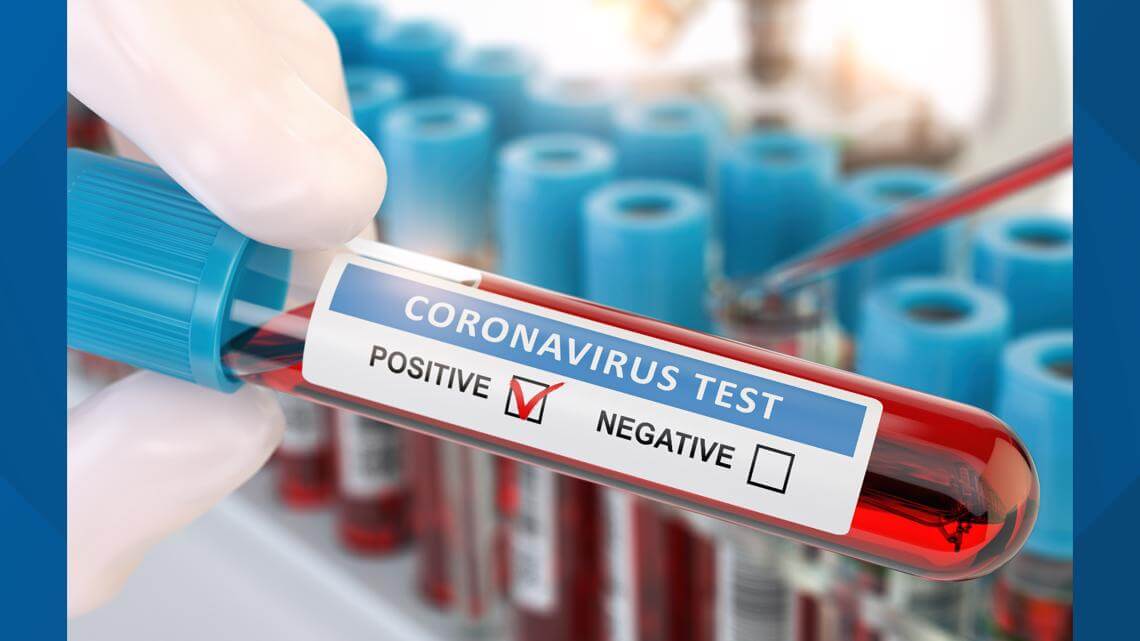 Koronavirusa yoluxanların bu günə olan statistikası
