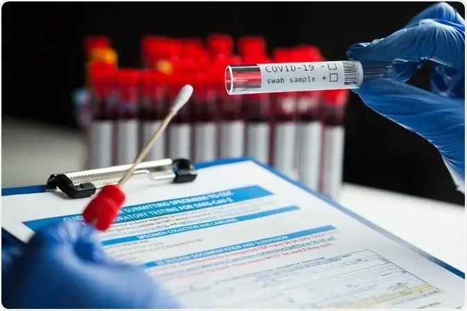 Koronavirusa yoluxanların bu günə olan statistikası