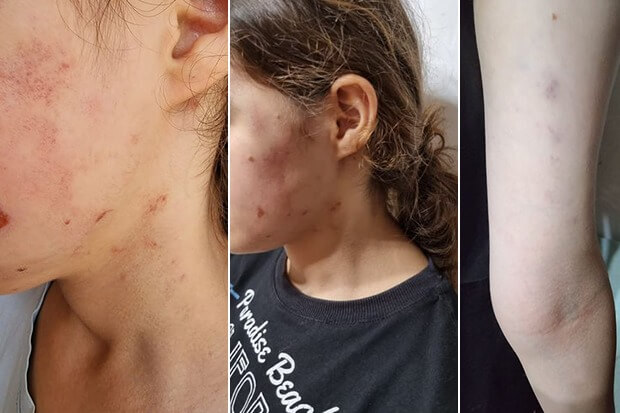 Yeniyetmə qızı döydüyü iddia edilən icra başçısının müavinindən açıqlama – EKSKLÜZİV