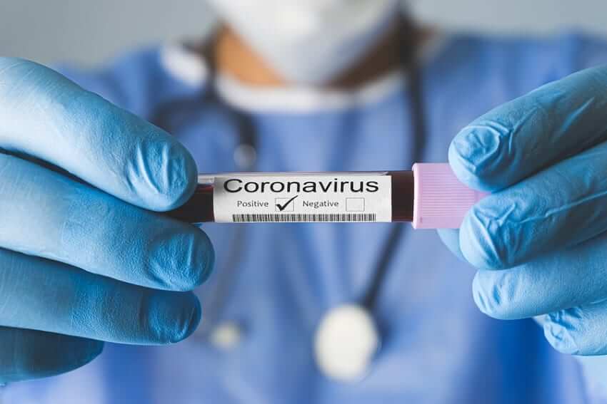 Koronavirusa yoluxanların bu günə olan statistikası