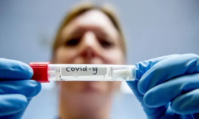 Koronavirusa yoluxanların bu günə olan statistikası