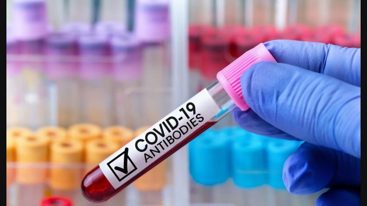 Koronavirusa yoluxanların bu günə olan statistikası