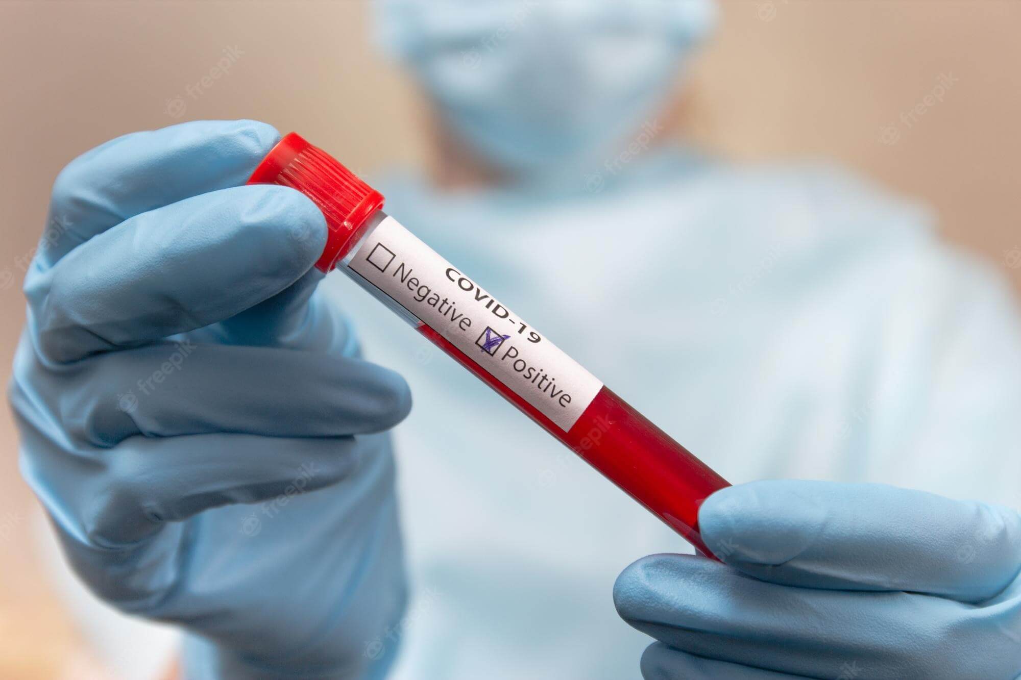 Koronavirusa yoluxanların bu günə olan statistikası