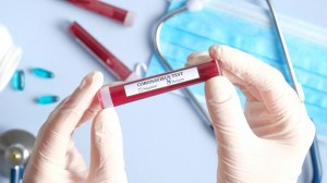 Azərbaycanda daha 120 nəfər COVID-19-a yoluxub – FOTO