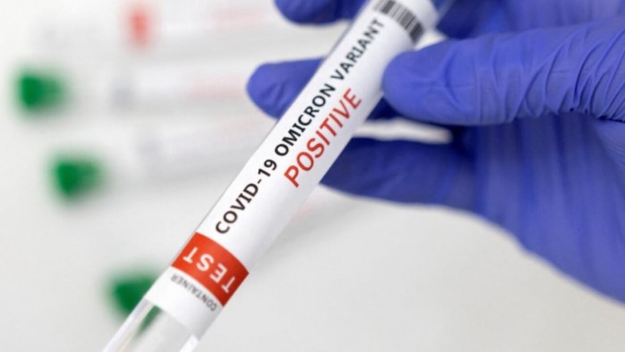 Azərbaycanda daha 15 nəfər COVID-19-a yoluxub - FOTO