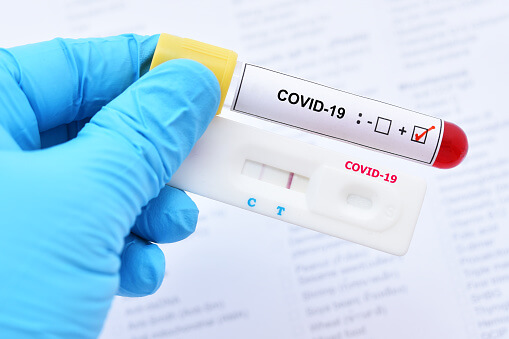 Azərbaycanda daha 34 nəfər COVID-19-a yoluxub