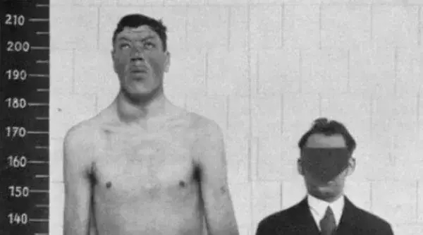 19 yaşında 1.42 m, 51 yaşında isə 2.34 m olan qəribə insan: Adam Rainer