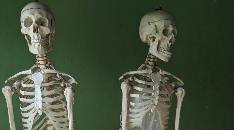Niyə insanlar 300 sümüklə doğulub 206 sümüklə ölürlər?