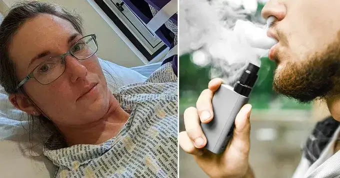 Cibindəki elektron siqaret yandı: Gənc qadın ağır yaralandı