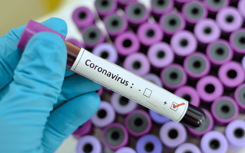 Koronavirusa 595 yeni yoluxma faktı qeydə alındı – SON STATİSTİKA