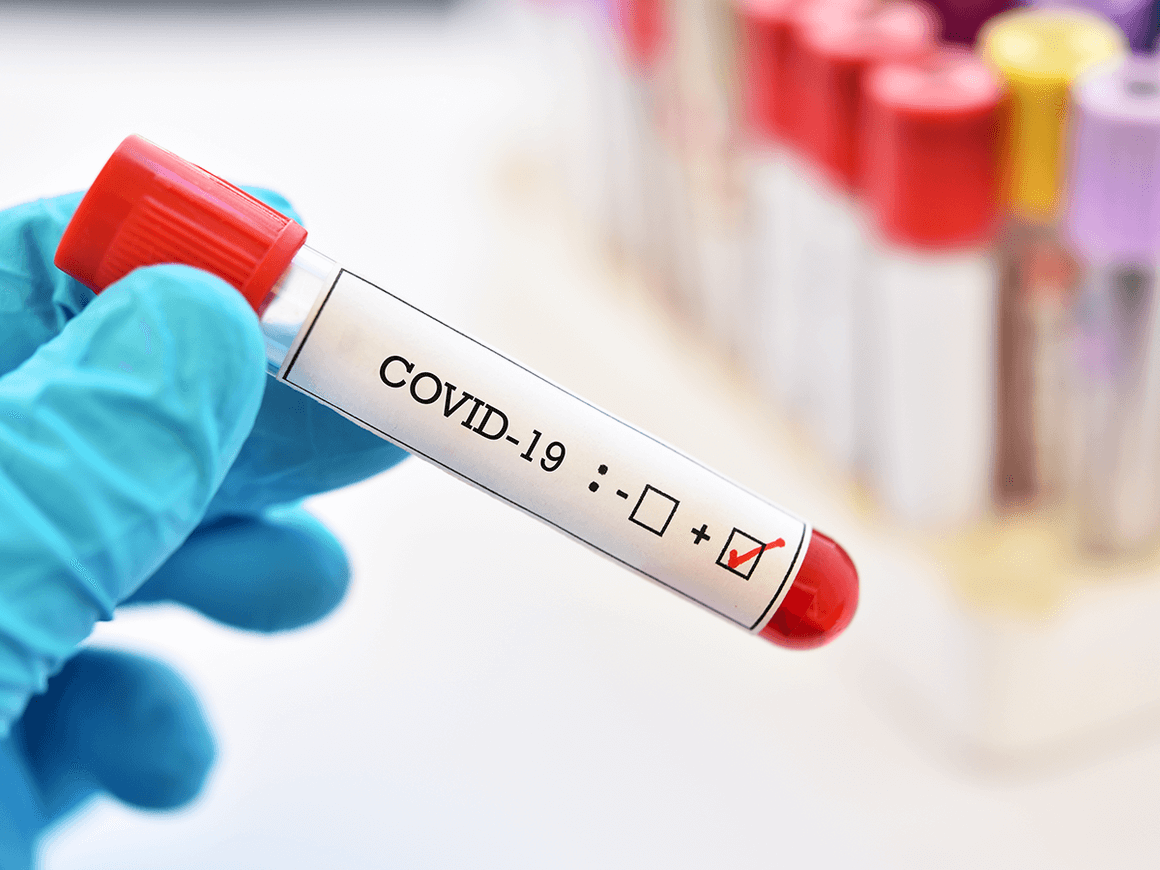 Koronavirusa yoluxanların bu günə olan statistikası