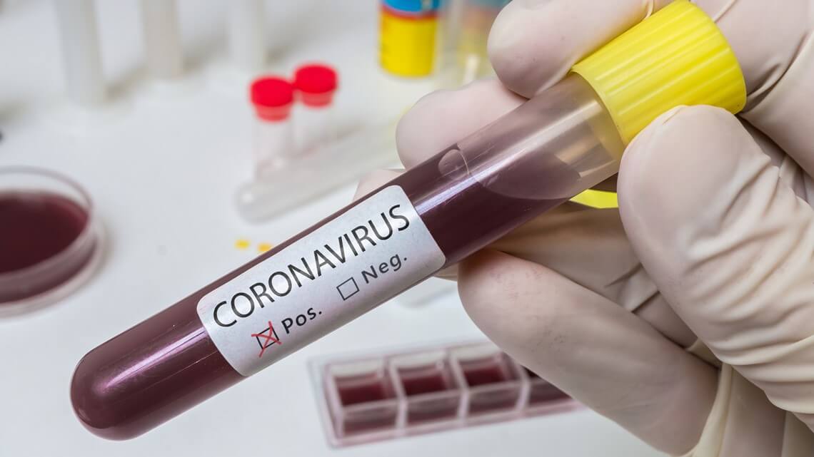 Koronavirusa yoluxanların bu günə olan statistikası