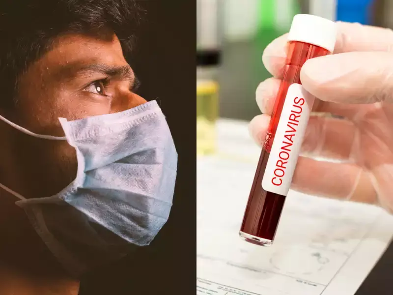 Koronavirusa yoluxma sayı kəskin azalıb