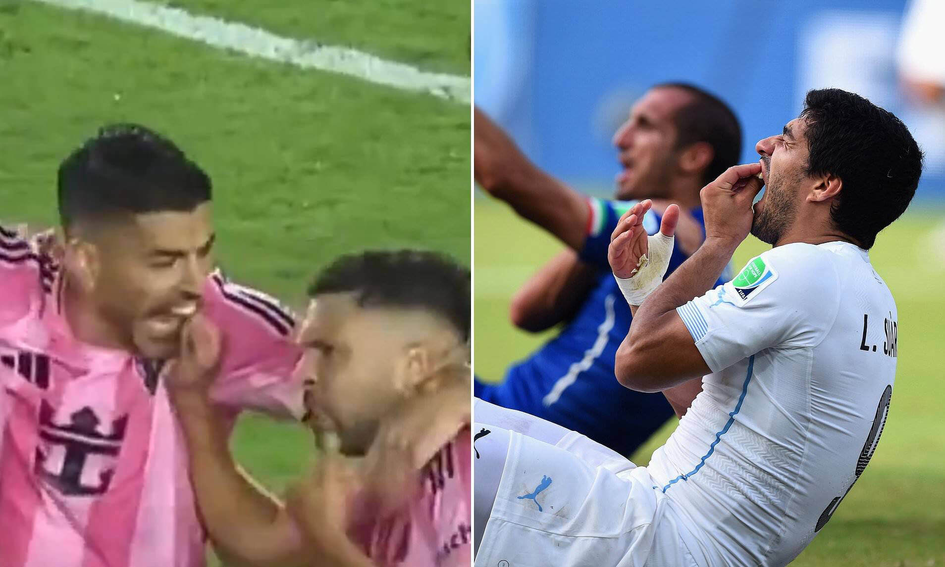 Luis Suares komanda yoldaşı Albanı dişləyib